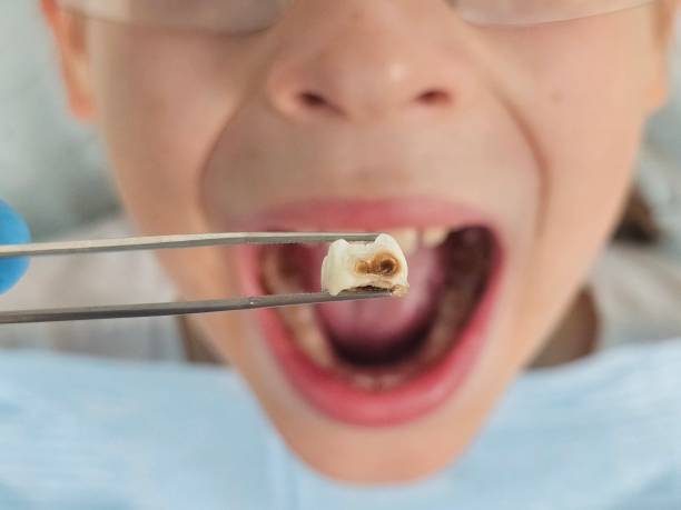 Best Emergency Dentist for Special Needs Patients in Johnstown, CO